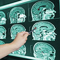 Scans of a brain from and MRI